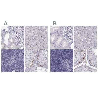 <b>Independent Antibodies Validation. </b>Immunohistochemistry-Paraffin: MAGEB2 Antibody [NBP2-62697] - Staining of human kidney, liver, lymph node and testis using Anti-MAGEB2 antibody NBP2-62697 (A) shows similar protein distribution across tissues to independent antibody NBP2-62688 (B).