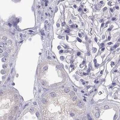 Immunohistochemistry-Paraffin: MAGEB2 Antibody [NBP2-62697] - Staining of human kidney.