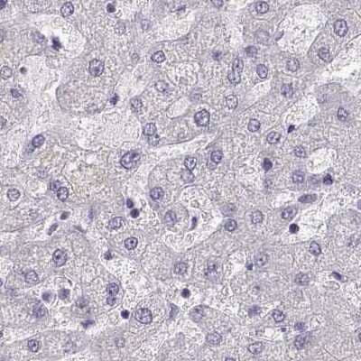 Immunohistochemistry-Paraffin: MAGEB2 Antibody [NBP2-62697] - Staining of human liver.