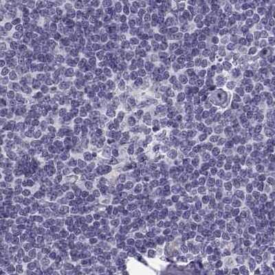 Immunohistochemistry-Paraffin: MAGEB2 Antibody [NBP2-62697] - Staining of human lymph node.