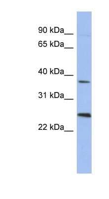 Western Blot: MAGEB2 Antibody [NBP1-56839] - Human Placenta lysate, concentration 0.2-1 ug/ml.