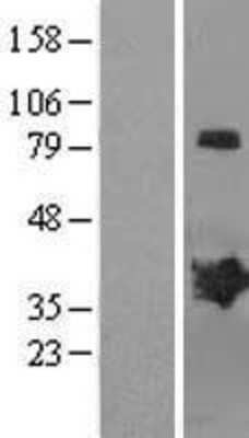 Western Blot: MAGEB2 Overexpression Lysate (Adult Normal) [NBL1-12809] Left-Empty vector transfected control cell lysate (HEK293 cell lysate); Right -Over-expression Lysate for MAGEB2.