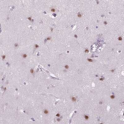 Immunohistochemistry-Paraffin: MAGEB3 Antibody [NBP2-58828] - Immunohistochemical staining of human cerebral cortex shows moderate nuclear positivity in neuronal cells.