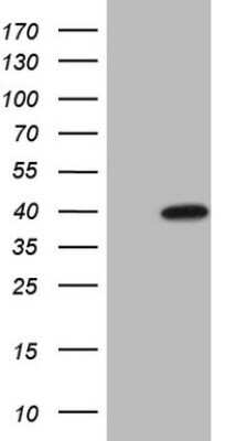 Western Blot: MAGEB3 Antibody (OTI5H8) - Azide and BSA Free [NBP2-72579] - Analysis of HEK293T cells were transfected with the pCMV6-ENTRY control (Left lane) or pCMV6-ENTRY MAGEB3.