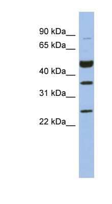 Western Blot: MAGEB3 Antibody [NBP1-56934] - Human Brain lysate, concentration 0.2-1 ug/ml.