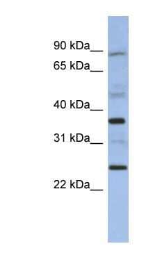 Western Blot: MAGEB3 Antibody [NBP1-57659] - Human Brain lysate, concentration 0.2-1 ug/ml.