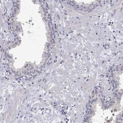 Immunohistochemistry-Paraffin MAGEB4 Antibody - BSA Free