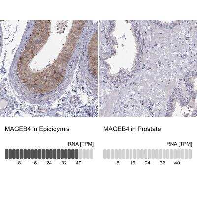 Immunohistochemistry-Paraffin MAGEB4 Antibody - BSA Free