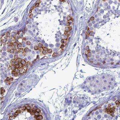 Immunohistochemistry-Paraffin: MAGEB6 Antibody [NBP1-84353] -  Staining of human testis shows strong cytoplasmic positivity in subset of cells of seminiferus ducts.