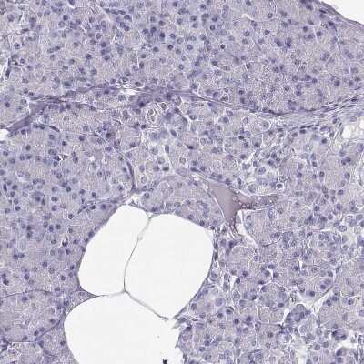 Immunohistochemistry-Paraffin: MAGEC1 Antibody [NBP1-85397] - Staining of human pancreas shows no cytoplasmic positivity in exocrine glandular cells.