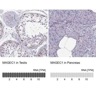 Immunohistochemistry-Paraffin: MAGEC1 Antibody [NBP1-85397] - Staining in human testis and pancreas tissues.. Corresponding MAGEC1 RNA-seq data are presented for the same tissues.