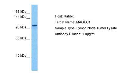 Western Blot: MAGEC1 Antibody [NBP2-83173] - Host: Rabbit. Target Name: MAGEC1. Sample Tissue: Human Lymph Node Tumor lysates. Antibody Dilution: 1ug/ml
