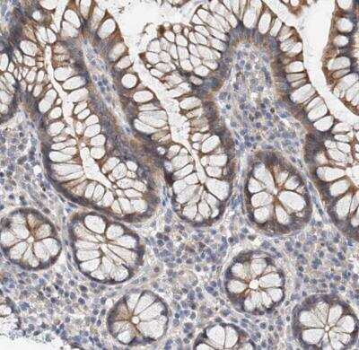 Immunohistochemistry-Paraffin MAGEE2 Antibody - BSA Free