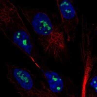 Immunocytochemistry/Immunofluorescence: MAGEH1 Antibody [NBP3-17272] - Staining of human cell line ASC TERT1 shows localization to nucleoli.