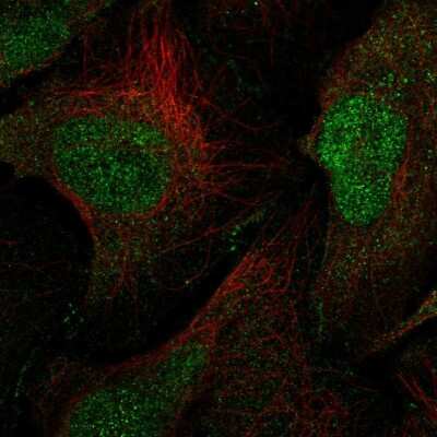 Immunocytochemistry/Immunofluorescence: MAGI1 Antibody [NBP2-58071] - Staining of human cell line U-2 OS shows localization to nucleoplasm & cell junctions.