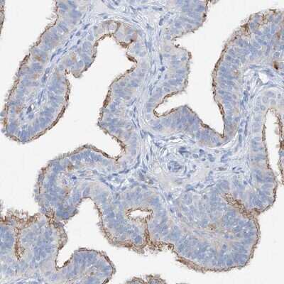 Immunohistochemistry-Paraffin: MAGI1 Antibody [NBP1-89182] - Staining of human fallopian tube shows high expression.