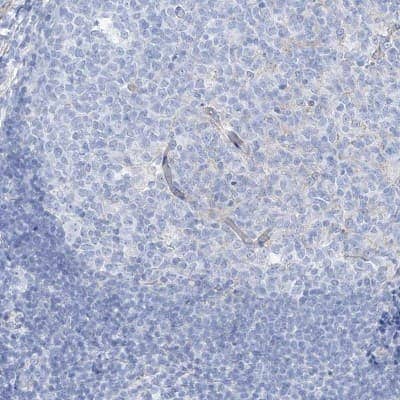 <b>Orthogonal Strategies Validation. </b>Immunohistochemistry-Paraffin: MAGI1 Antibody [NBP1-89182] - Staining of human tonsil shows low expression as expected.