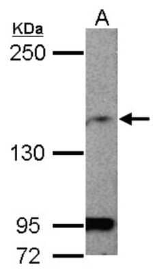 Western Blot: MAGI1 Antibody [NBP2-17209] - Sample (50 ug of whole cell lysate) A: Mouse Brain, 5% SDS PAGE gel, diluted at 1:1000.