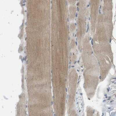 Immunohistochemistry-Paraffin: MAGI2 Antibody [NBP1-89261] - Staining of human skeletal muscle shows weak to moderate cytoplasmic positivity in myocytes.