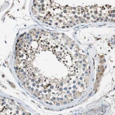 Immunohistochemistry-Paraffin: MAGI2 Antibody [NBP1-89261] - Staining of human testis shows moderate to strong cytoplasmic positivity in cells in seminiferous ducts.