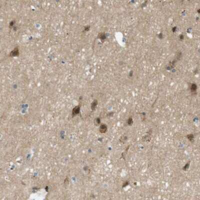 Immunohistochemistry-Paraffin: MAGI2 Antibody [NBP1-89261] - Staining of human cerebral cortex shows moderate to strong cytoplasmic positivity in neurons.