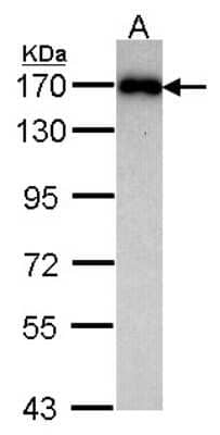 Western Blot: MAGI2 Antibody [NBP1-31015] - Sample (30 ug of whole cell lysate) A: Raji 7. 5% SDS PAGE MAGI-2 antibody, antibody diluted at 1:1000.