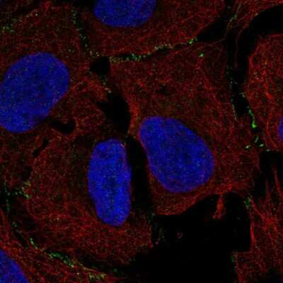 Immunocytochemistry/Immunofluorescence: MAGI3 Antibody [NBP2-58916] - Staining of human cell line U-2 OS shows localization to cell junctions.