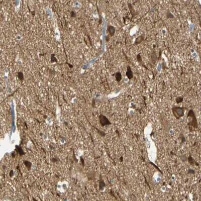 Immunohistochemistry-Paraffin: MAGI3 Antibody [NBP1-81266] - Staining of human cerebral cortex shows strong cytoplasmic positivity in neurons as well as moderate staining in neuropil.