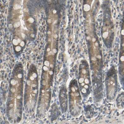 Immunohistochemistry-Paraffin: MAGI3 Antibody [NBP1-81266] - Staining of human duodenum shows moderate cytoplasmic positivity in glandular cells.