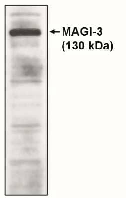 Western Blot: MAGI3 Antibody [NBP3-11883] - Western blot analysis using MAGI3, GKWW antibody on cell lysates transfected with full-length human MAGI-3 protein.