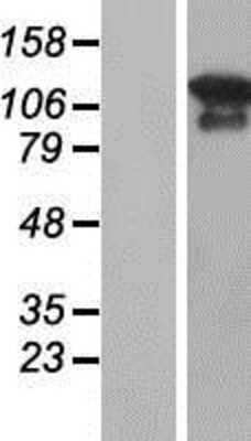 Western Blot: MAGI3 Overexpression Lysate (Adult Normal) [NBP2-05304] Left-Empty vector transfected control cell lysate (HEK293 cell lysate); Right -Over-expression Lysate for MAGI3.