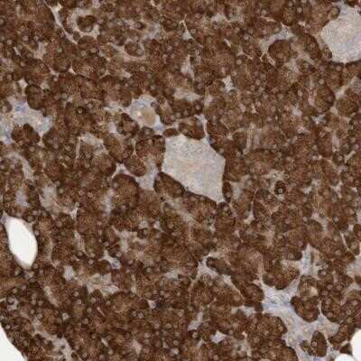 Immunohistochemistry-Paraffin: MAGIX Antibody [NBP1-93951] - Staining of human pancreas shows strong cytoplasmic positivity in exocrine glandular cells.