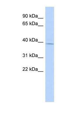 Western Blot MAGT1 Antibody