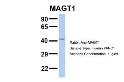 Western Blot: MAGT1 Antibody [NBP1-69683] - PANC1, Antibody Dilution: 1.0 ug/ml MAGT1 is supported by BioGPS gene expression data to be expressed in PANC1.