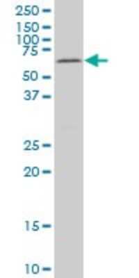 Western Blot: MAK Antibody (3E5) [H00004117-M01] - MAK monoclonal antibody (M01), clone 3E5 Analysis of MAK expression in HepG2.