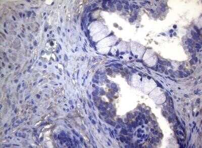 Immunohistochemistry: MAK Antibody (OTI5A7) - Azide and BSA Free [NBP2-72580] - Staining of paraffin-embedded Carcinoma of Human prostate tissue using anti-MAK mouse monoclonal antibody.