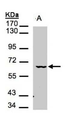 Western Blot: MAK Antibody [NBP1-32344] - Sample(30 ug of whole cell lysate)A:Raji 7. 5% SDS PAGE, antibody diluted at 1:1000.