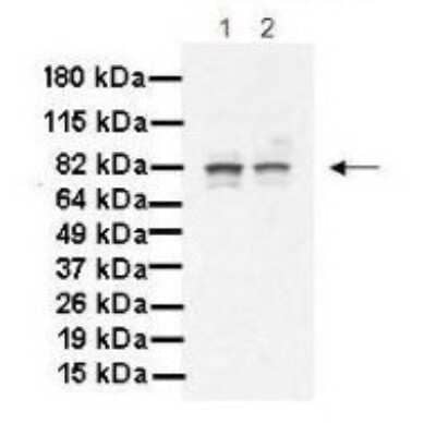 Western Blot: MAK Antibody [NBP1-54991] - Titration: 1 ug/ml Positive Control: Human pancreatic cancer cell line MiaPaca-2 and Panc-1.