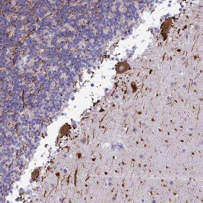 Immunohistochemistry-Paraffin MAK3 Antibody - BSA Free