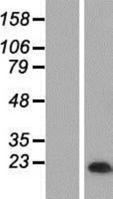 Western Blot: MAL Overexpression Lysate (Adult Normal) [NBP2-06445] Left-Empty vector transfected control cell lysate (HEK293 cell lysate); Right -Over-expression Lysate for MAL.