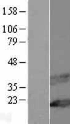 Western Blot: MAL Overexpression Lysate (Adult Normal) [NBP2-06446] Left-Empty vector transfected control cell lysate (HEK293 cell lysate); Right -Over-expression Lysate for MAL.