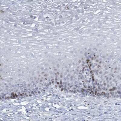 Immunohistochemistry-Paraffin: MALL Antibody [NBP2-14215] - Staining of human esophagus shows moderate cytoplasmic positivity in squamous epithelial cells.