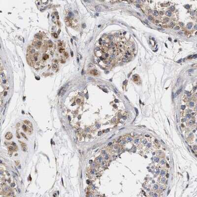 Immunohistochemistry-Paraffin: MALSU1 Antibody [NBP1-86026] - Staining of human testis shows strong granular cytoplasmic positivity in Leydig cells.