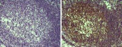 Immunohistochemistry-Paraffin: MALT1 Antibody (50) [NBP1-43120] - Formalin-fixed paraffin embedded human tonsil tissue with citrate buffer antigen retrieval, using 10 ug/ml of Anti-Human MALT1 Purified (right) or Mouse IgG1 k Isotype Control Purified antibody (left) followed by Anti-Mouse Ig Biotin and DAB visualization. Nuclei are counterstained with hematoxylin.