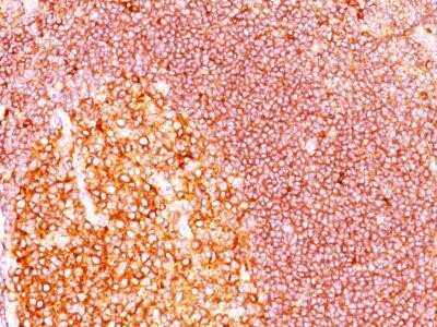 Immunohistochemistry-Paraffin: MALT1 Antibody (MT1/410) - Azide and BSA Free [NBP2-33054] - Formalin-fixed, paraffin-embedded tonsil stained with MALT1 Ab (MT1/410)