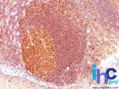 Immunohistochemistry-Paraffin: MALT1 Antibody (MT1/410) - IHC-Prediluted [NBP2-44348] - Formalin-fixed, paraffin-embedded human tonsil stained with MALT1 MT1/410 antibody (1:200), peroxidase-conjugate and DAB chromogen.