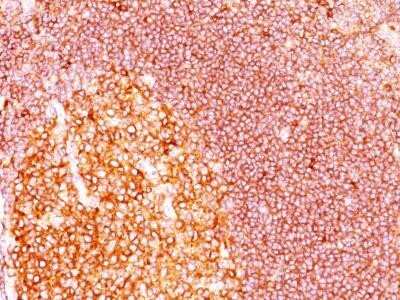 Immunohistochemistry-Paraffin: MALT1 Antibody (MT1/410) - IHC-Prediluted [NBP2-44348] - Formalin-fixed, paraffin-embedded tonsil stained with MALT1 Ab (MT1/410)