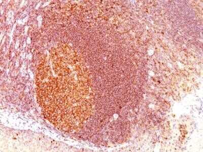 Immunohistochemistry-Paraffin: MALT1 Antibody (SPM578) - IHC-Prediluted [NBP2-44349] - Human Tonsil stained with MALT1 Antibody (SPM578)