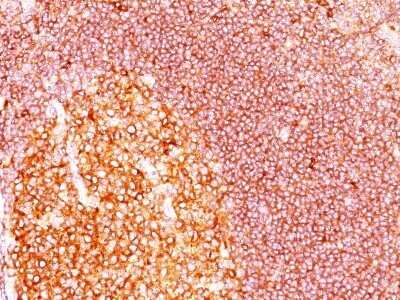 Immunohistochemistry-Paraffin: MALT1 Antibody (SPM578) - IHC-Prediluted [NBP2-44349] - Human tonsil stained with MALT1 MAb (SPM578)