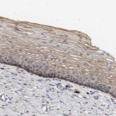 Immunohistochemistry-Paraffin: MAMDC2 Antibody [NBP1-81169] - Staining of human cervix, uterine shows moderate to strong cytoplasmic positivity in squamous epithelial cells.